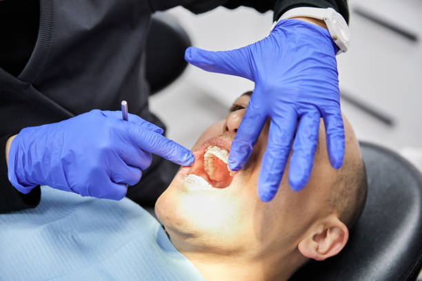 Best Emergency Dentist for Lost Fillings or Crowns in Mckees Rocks, PA